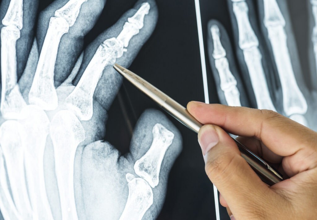 Top Radiology Annotation Tools Powering Healthcare AI