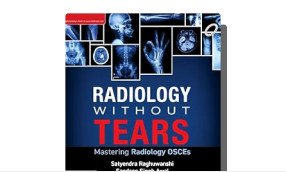 Radiology Without Tears: Mastering Radiology Osces