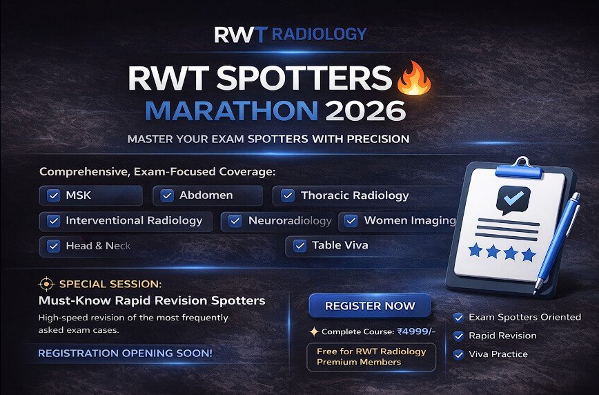 RWT SPOTTERS MARATHON 🔥 (LIVE 8 SESSIONS)